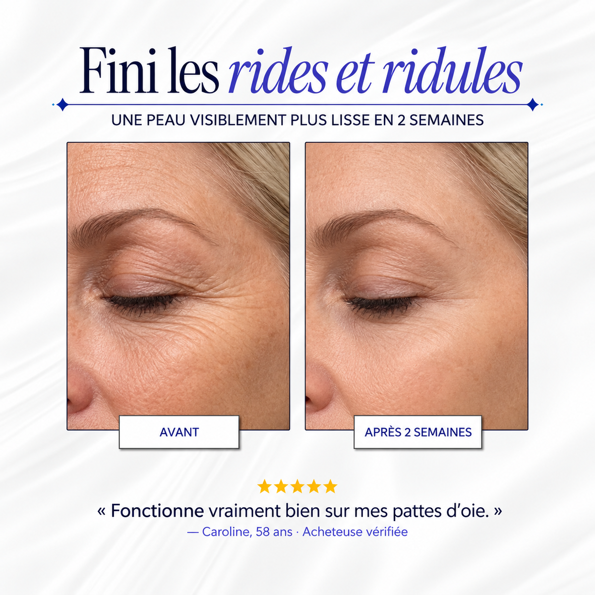Bandes de Collagène en Silicone Vantyx™