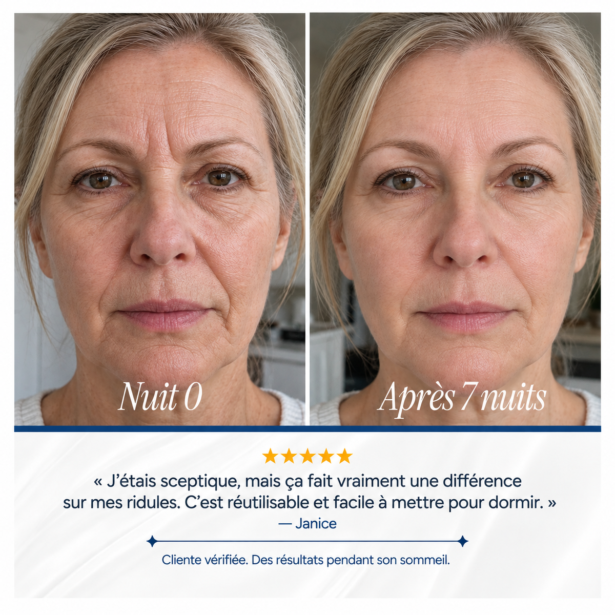 Bandes de Collagène en Silicone Vantyx™